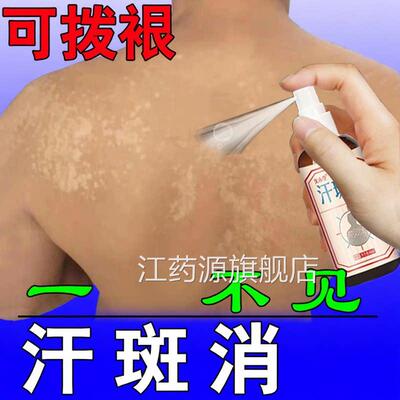 汗斑净汉斑露花斑专用治花喷斑皮肤去腋下白斑剂止痒抑菌膏江药源