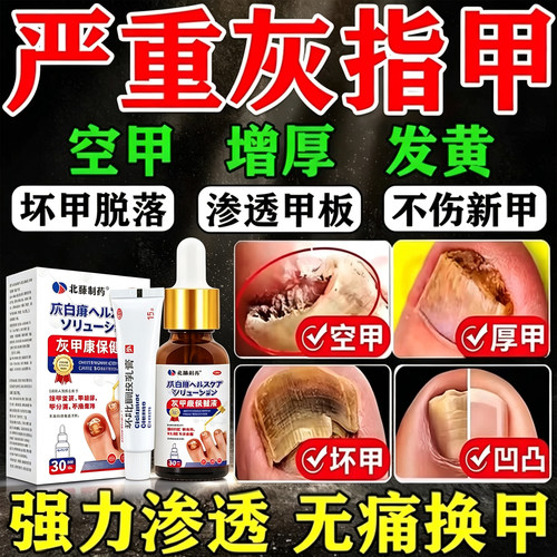 [亮生]环吡酮胺乳膏1%*15g*1支/盒