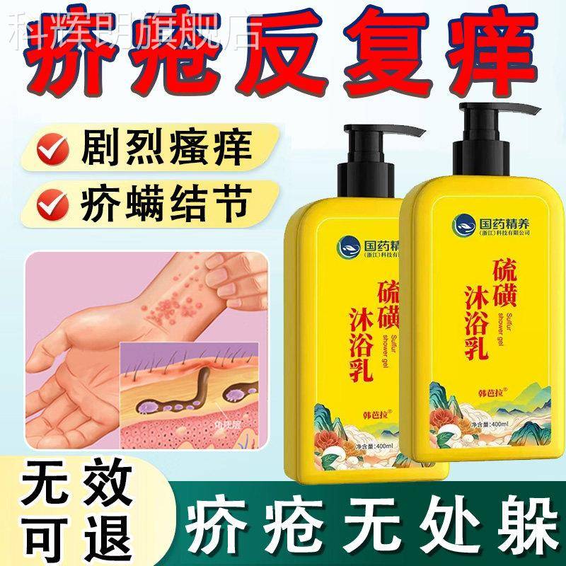 疥疮疥螨特治疥虫皮干燥瘙痒的药效杀虫剂硫磺肤阴囊结节沐浴露YU