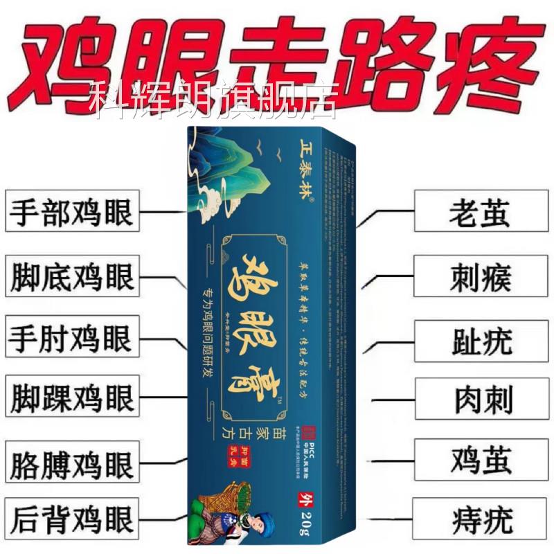 苗家古方】鸡眼膏鸡眼抑菌【液滁脚趾手指鸡眼肉刺顽固除反复生长