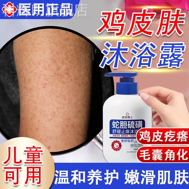 医用膊上的手臂鸡皮肤疙瘩毛囊角化专用沐浴露身体胳乳去除神器TK
