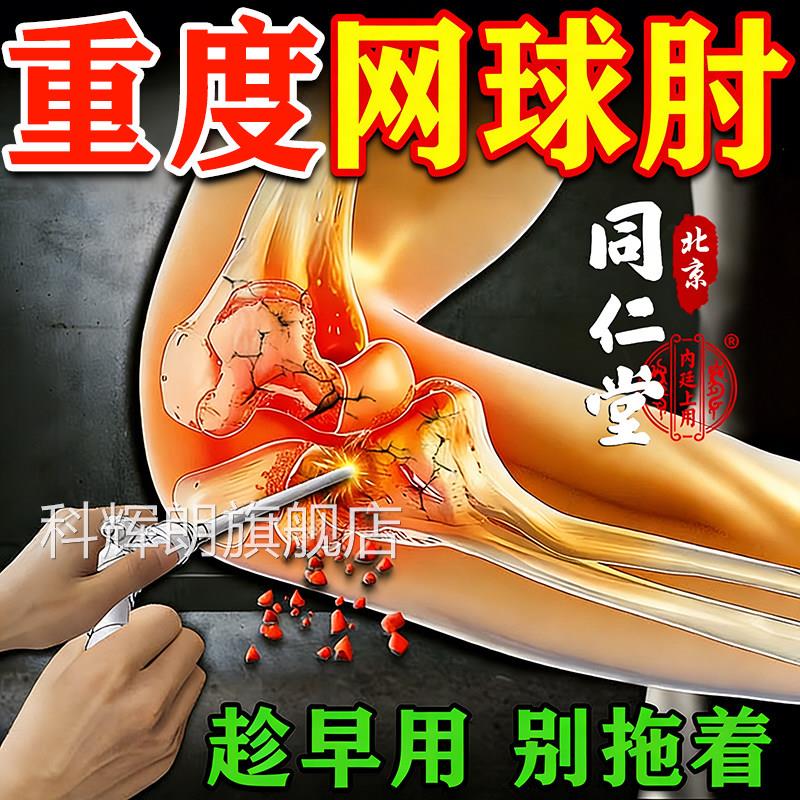 网球肘专用膏药特胳效膊克手星臂肘关节疼痛远红外贴筋骨痛贴膏科