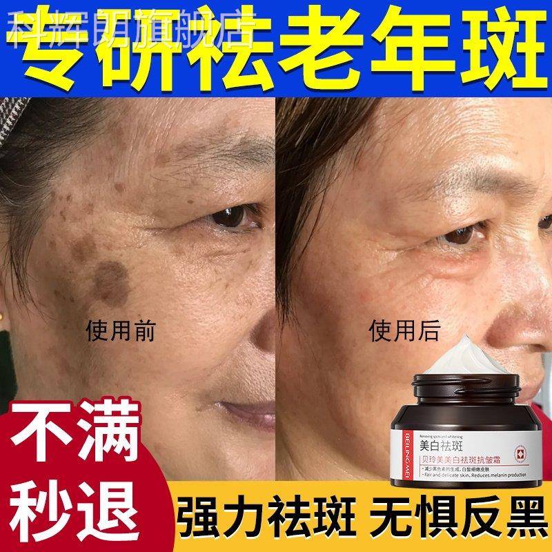 美白祛化斑霜去老年斑强力去除淡色斑祛斑祛黄褐斑雀斑官方正品科