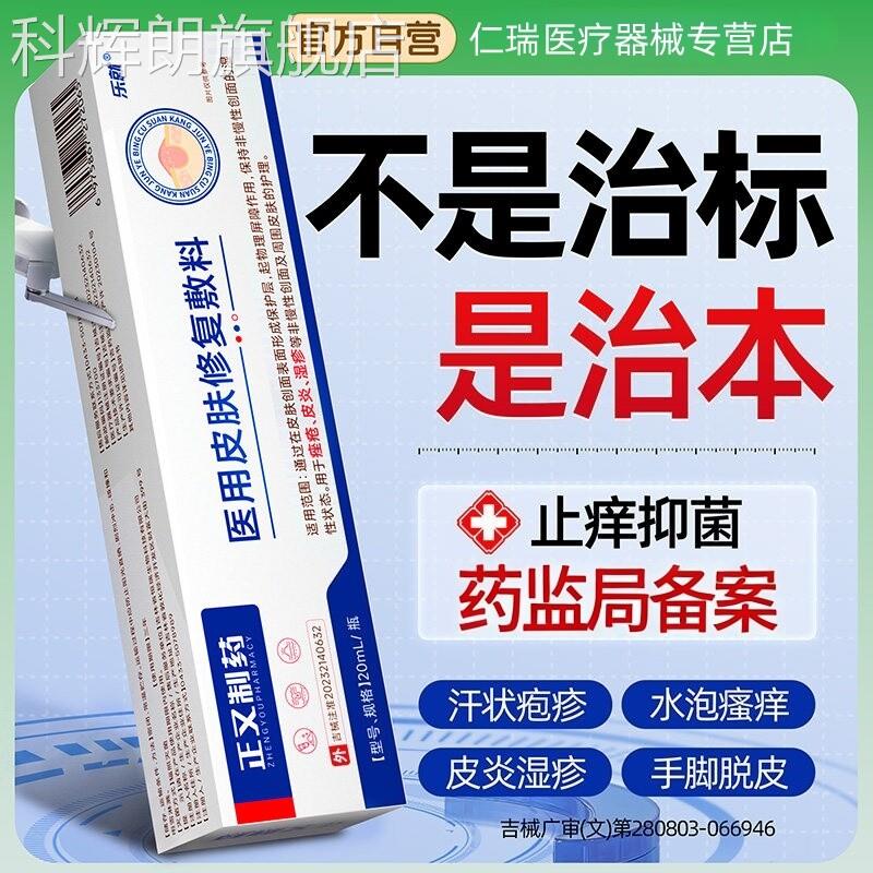 汗泡疹专特手上泡起小水湿疹止痒根去真菌感染角化型皮肤用效药膏