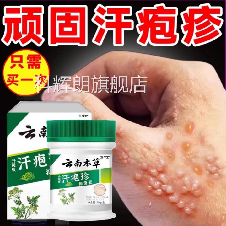 手上起小水泡抑菌汗泡疱止痒中药鹅掌风真菌气感染手湿痒疹专膏科
