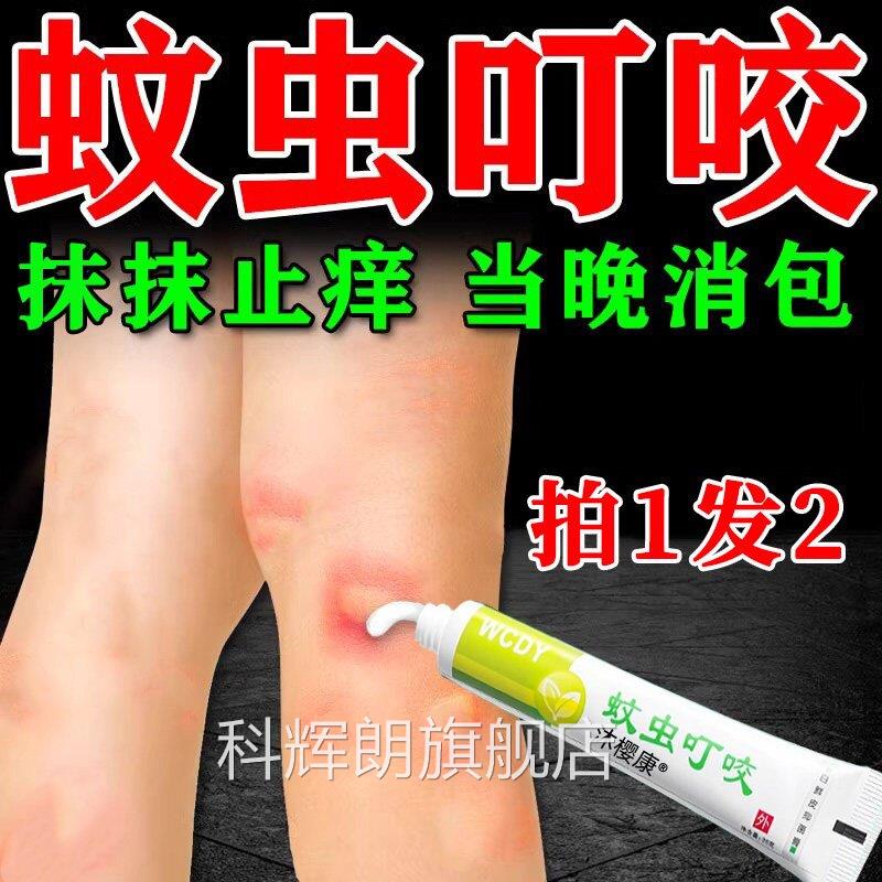 蚊虫叮咬快速止痒红消软膏婴宝宝成人儿童臭毒虫跳蚤蚊子咬肿包膏