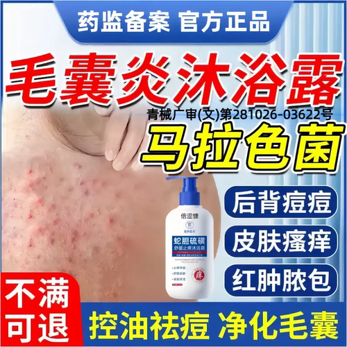 毛囊炎马拉色菌后背痘痘沐浴露前胸后背长脓包疙瘩痘真菌感染lm