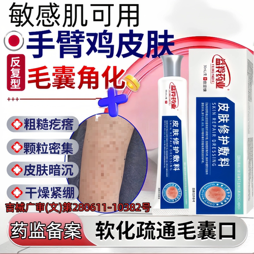 鸡皮肤疙瘩专毛用囊角化症