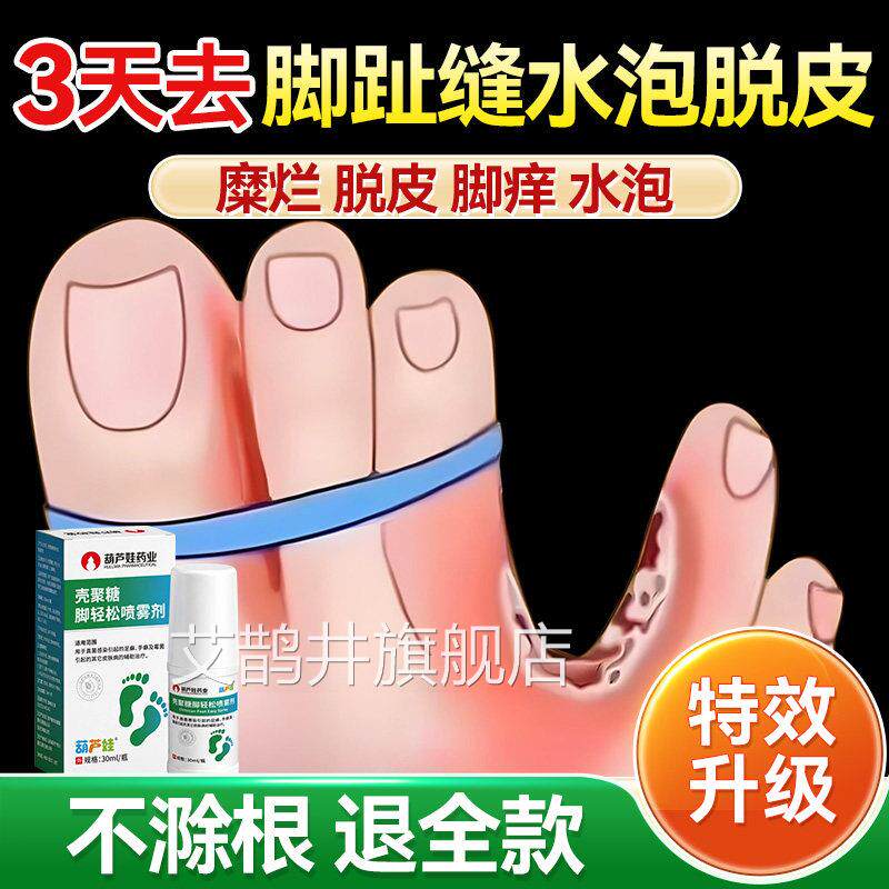 烂脚丫专用脚趾缝脱皮脚痒糜烂开裂水泡臭汗脚脚气去真菌感染喷剂