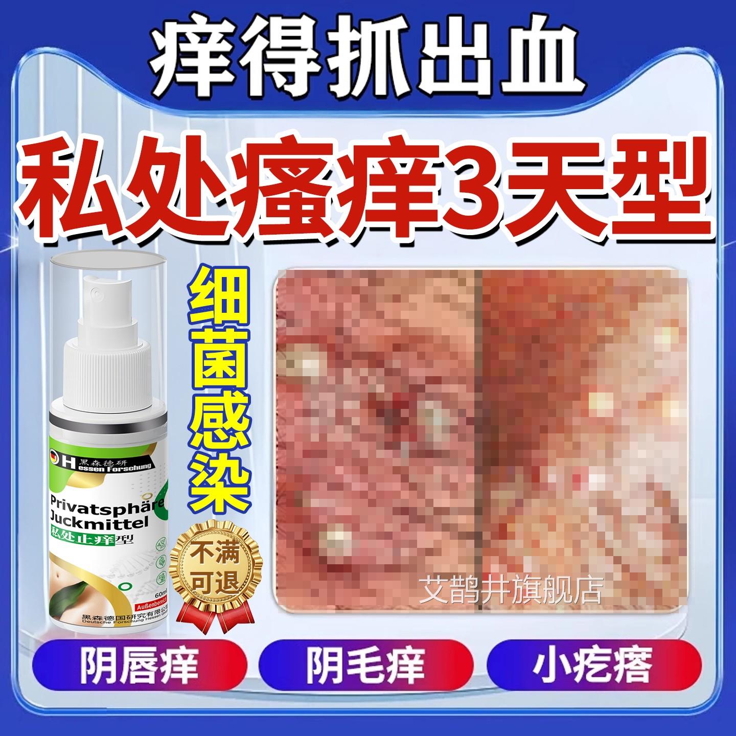 外瘙阴痒喷止痒雾女私处根去痒妇科阴道炎专抑菌私处洗护喷雾剂艾