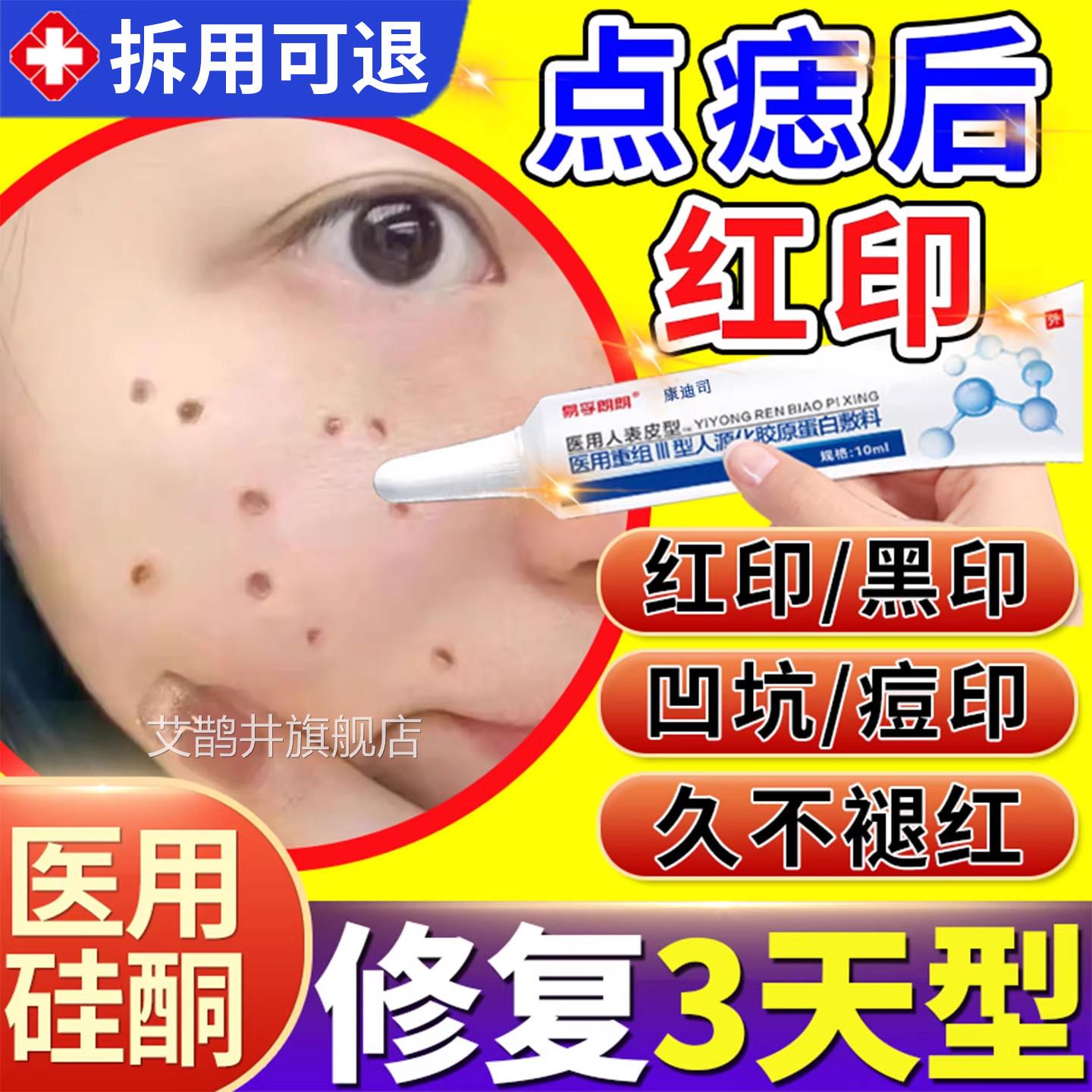 激光点斑痕祛痣点痣后去红印修复膏退红淡印液去痣凹陷疤专用T1艾