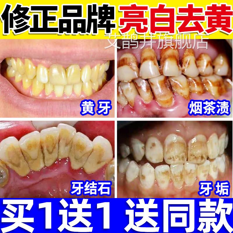洁牙粉可搭去黄洗白牙齿美白黄牙洗污垢去牙石神器除牙垢牙烟结渍