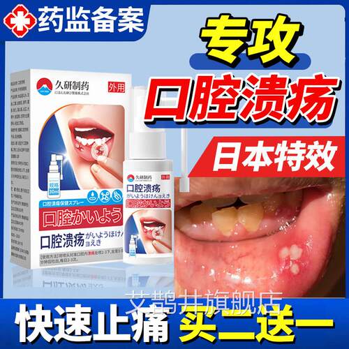 日嘴本口腔溃疡修复液喷雾喷剂凝胶一点灵药膏溃疡巴起泡口腔溃疡