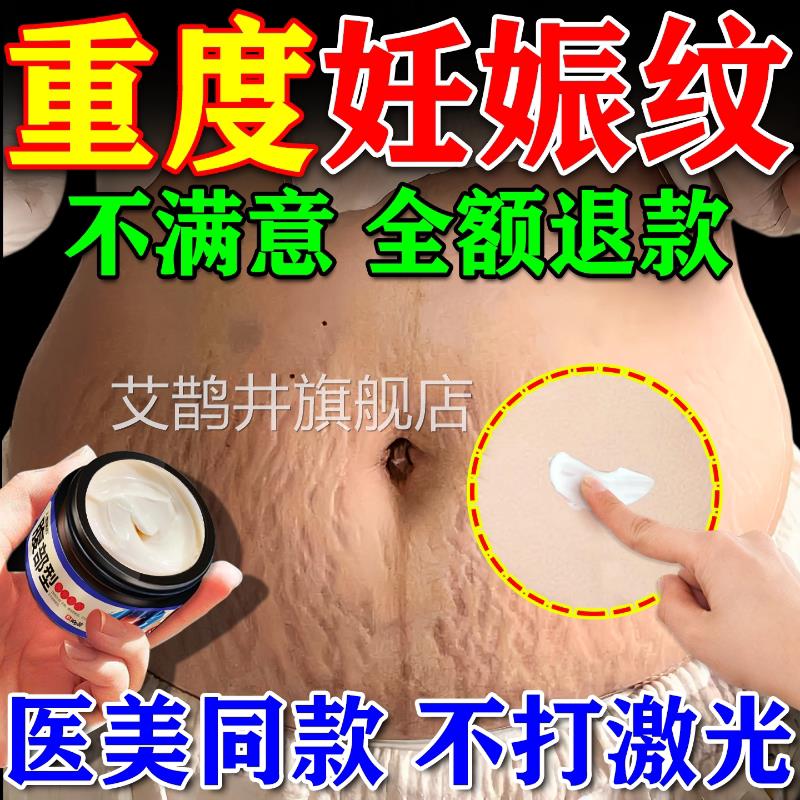 妊辰纹消除去妊修娠纹非紧致肚皮非复霜非淡化除疤痕膏遮盖神器艾
