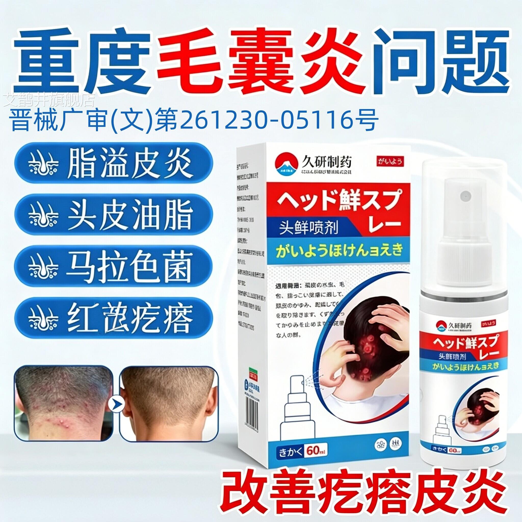 头皮毛囊炎长痘疙瘩红专头脸部特效上用脂溢性皮炎马拉色菌痒艾鹊