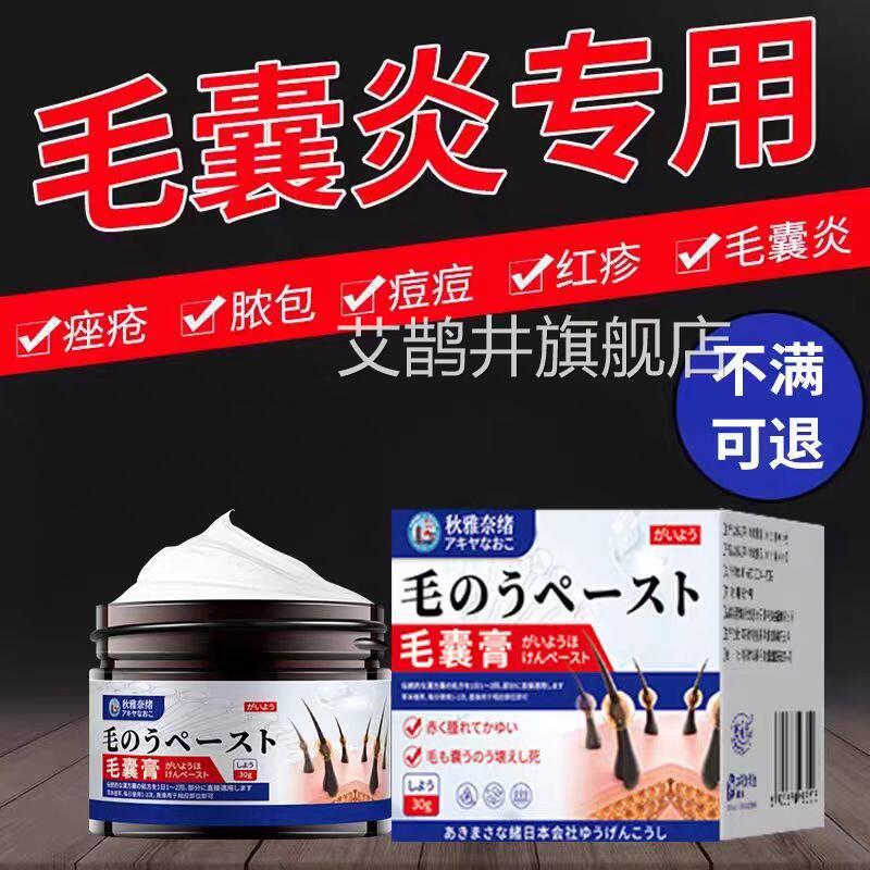 马拉色前胸后背治头皮毛囊炎专用头部脖子私处痘痘中菌药酊疗膏药