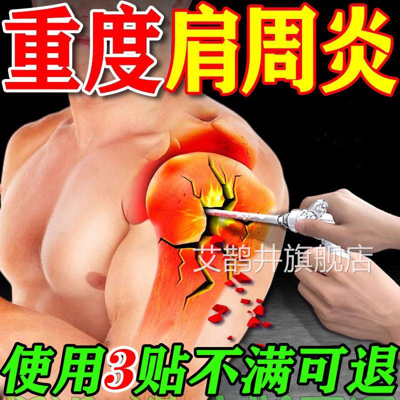 肩周专用贴膏肩膀酸痛抬不起胳炎膊肩袖损伤远红外肩周疼痛膏贴艾
