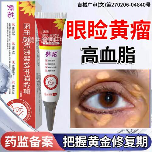 睑黄瘤去眼除神器睑黄瘤疣去眼皮黄斑瘤疣专用膏血脂高眼部脂肪粒