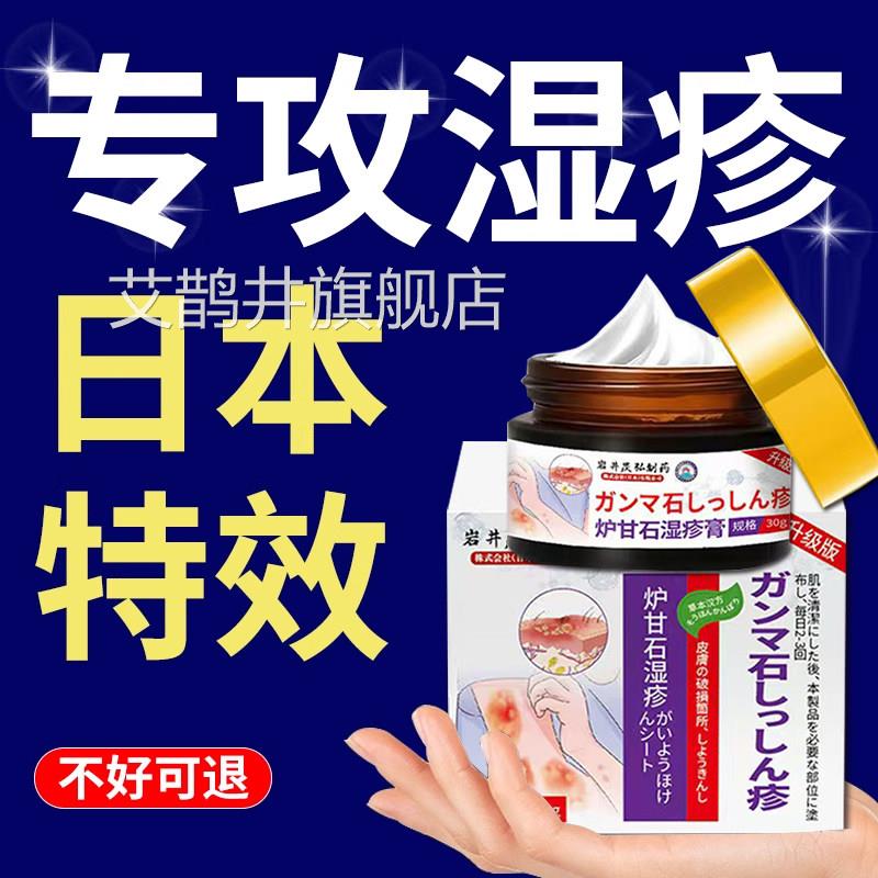 湿疹止痒去外用顽固根皮炎成人非湿疹膏特皮肤瘙痒效抑菌止痒药膏