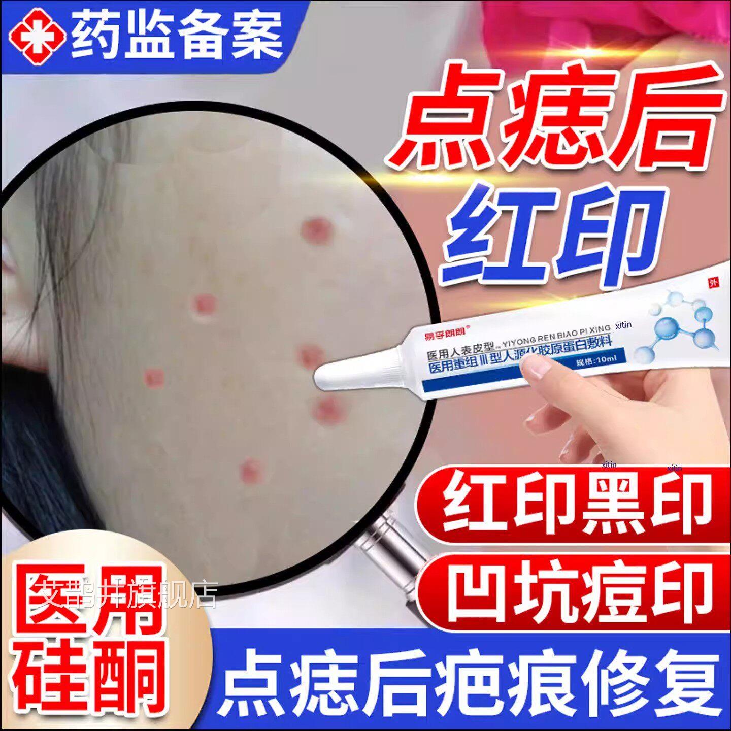 激光点斑祛痣点痣后去红印修复膏用退红淡印液去痣凹陷疤痕专TT艾