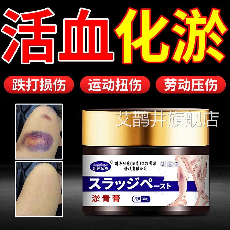 儿童淤青膏活摔血化瘀淤青快速消除撞伤伤散淤血成人消肿跌打损伤