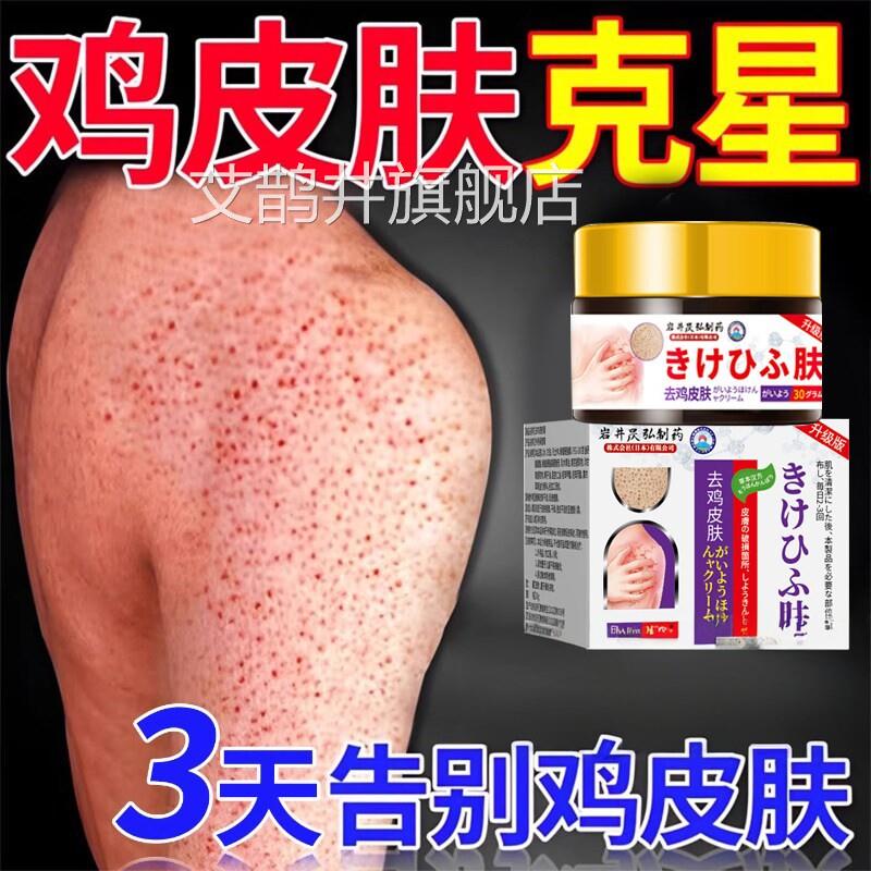 日本去鸡皮肤鱼鳞疙瘩毛囊角化症角质膏手臂身体去用除器永艾鹊井