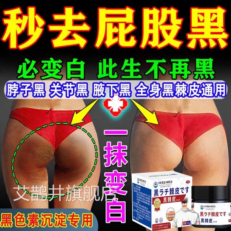 日本脖子大腿内侧黑色素沉淀去除屁股祛坐印发臀部黑坐茧黑棘皮膏