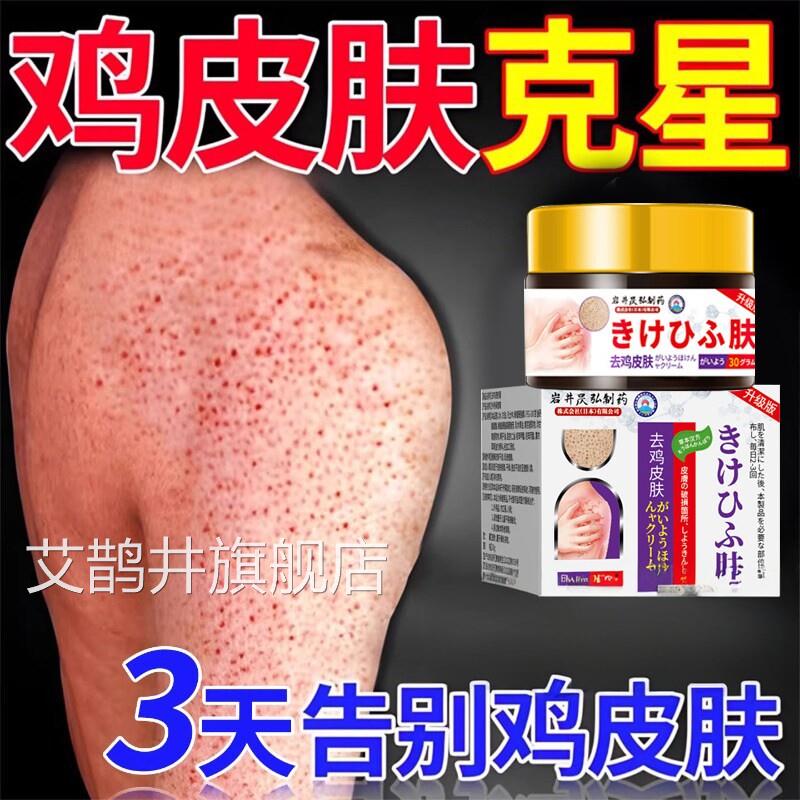 日本去鸡皮肤鱼鳞瘩毛囊角化症角质膏疙用手臂身体去除器永艾鹊井