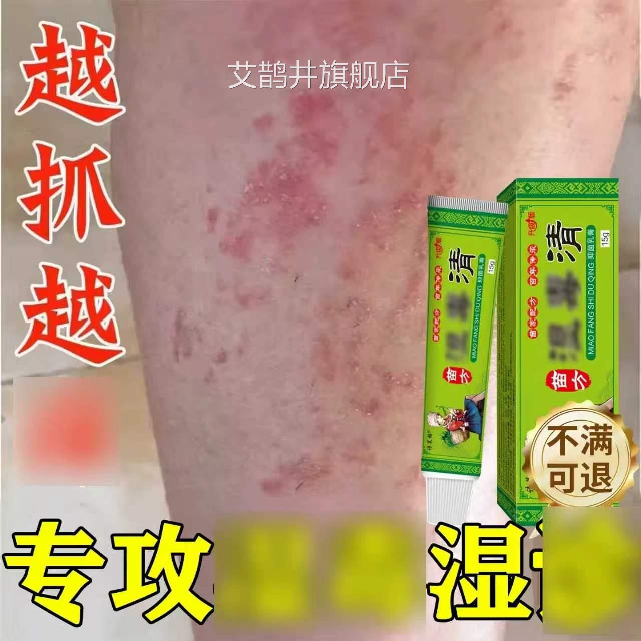 毒清抑菌软膏湿止痒皮肤专用药膏外用全身瘙痒旗舰店官方正品艾鹊