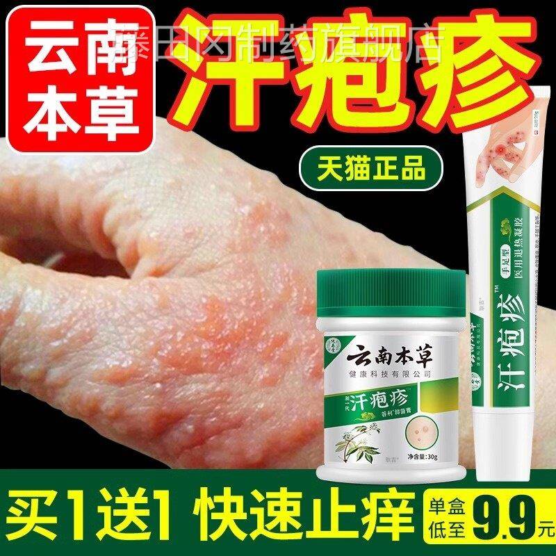 云南本孢草汗泡状疱JSR疹药膏汗疱疹手上湿疹疹汗泡珍包汗疹汗疱