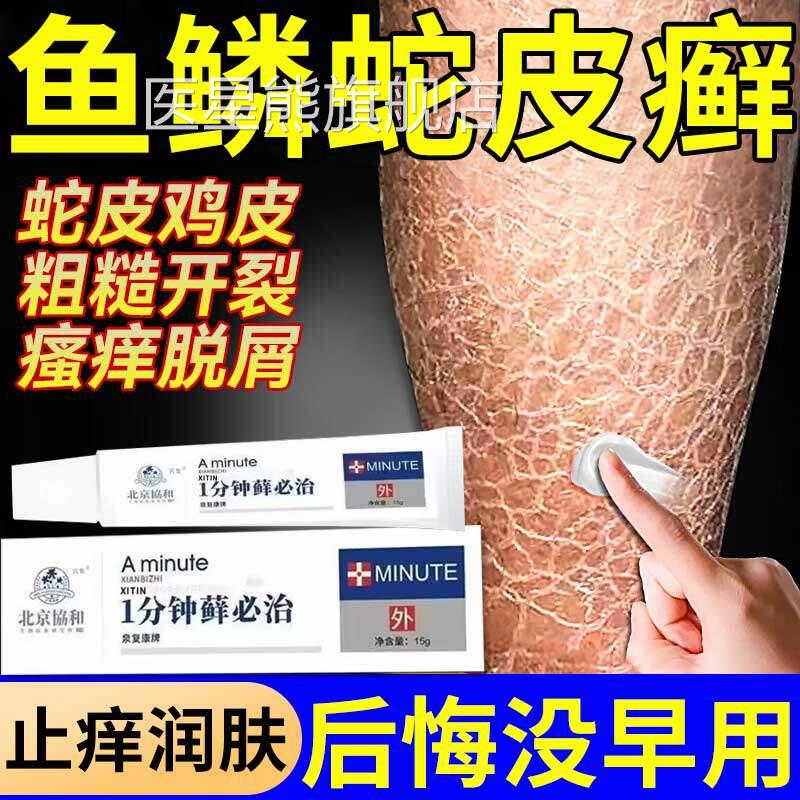 鱼鳞蛇皮肤霜干燥掉鳞去屑止痒身体乳鸡皮毛囊角化膏滋润不起皮ZT