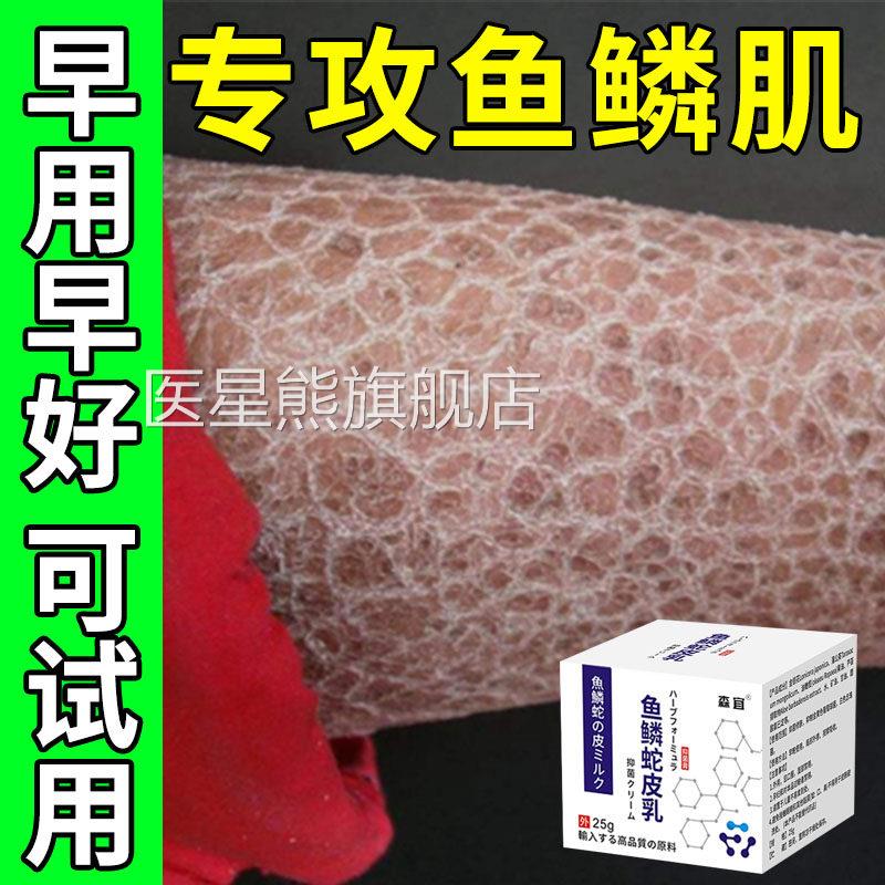 鱼鳞皮肤霜去鱼鳞小腿全身皮肤干脱润肤起皮病屑干皮保湿身燥体乳