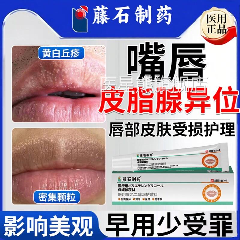 皮脂异位症嘴唇白点脂腺肪小颗粒疱疹去干裂脱皮增生除药房同售CA