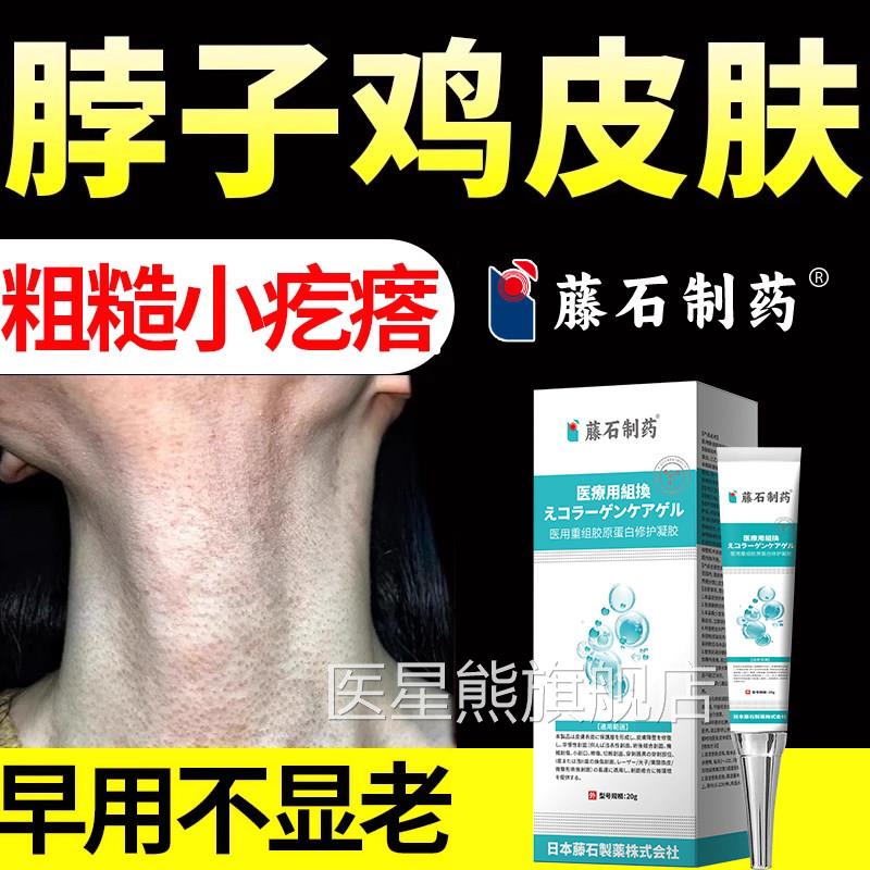 去炎脖子鸡皮肤去除疙瘩膏毛囊毛周角化症角质药房同售神器SK医星