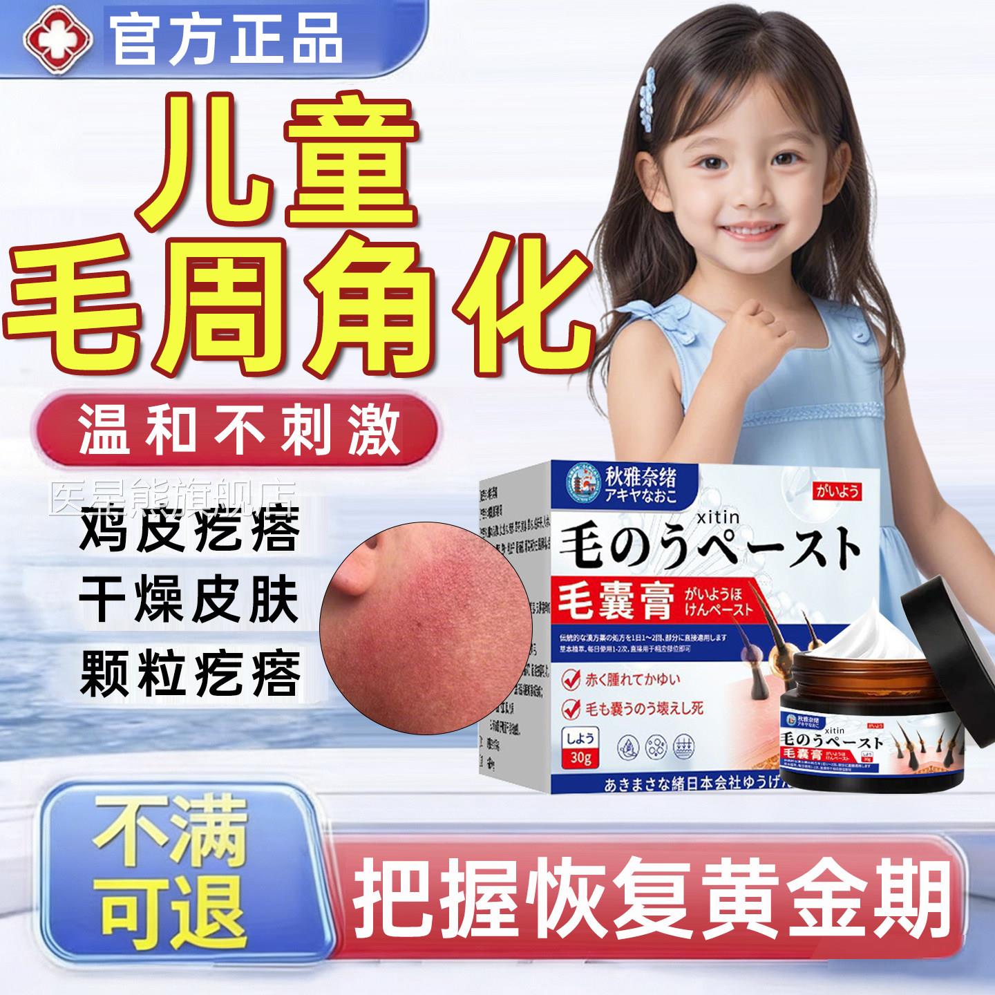 儿童毛周角化改善鸡皮肤疙瘩毛囊角化症医用去除全身脸部面专部PP