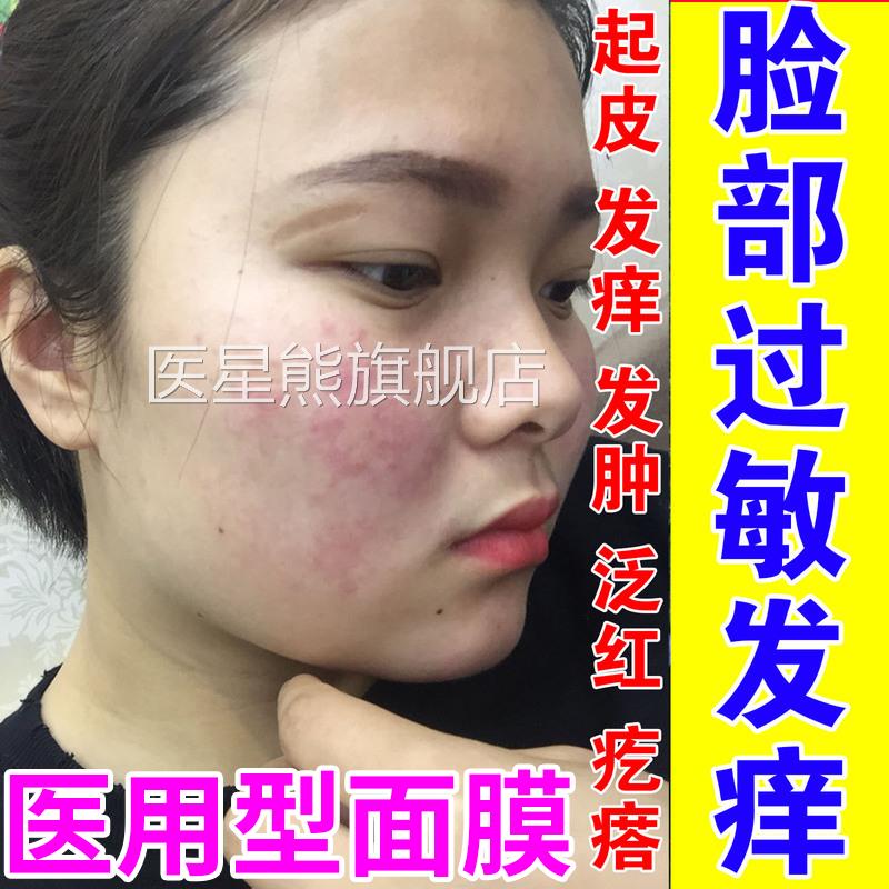脸过敏红痒修复医用型过敏皮肤修复脸部敏医用敷贴抗过面敏感肌膜