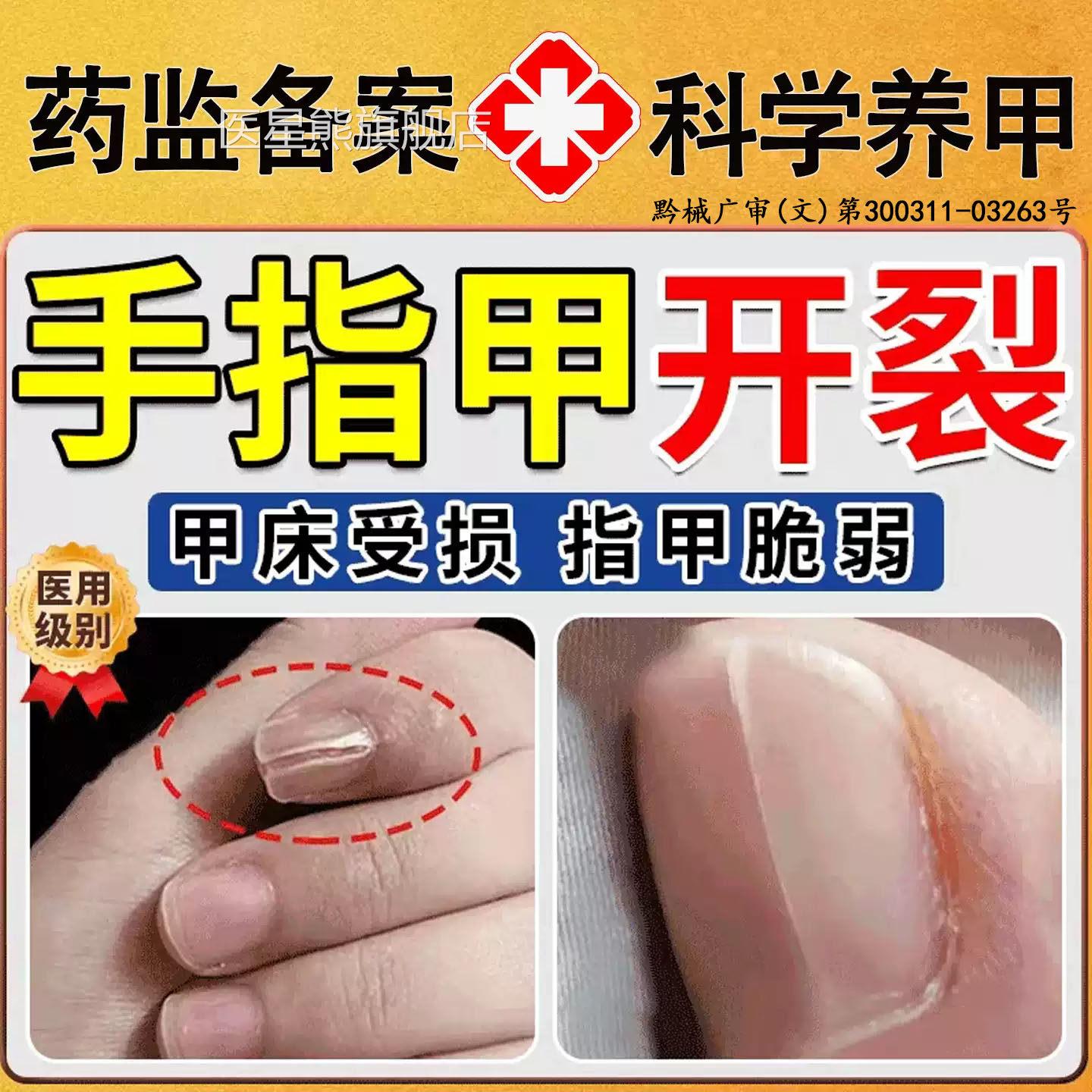 手脚趾甲指甲裂开修复断劈裂竖裂纹开裂受损再生养甲床药修复液BD