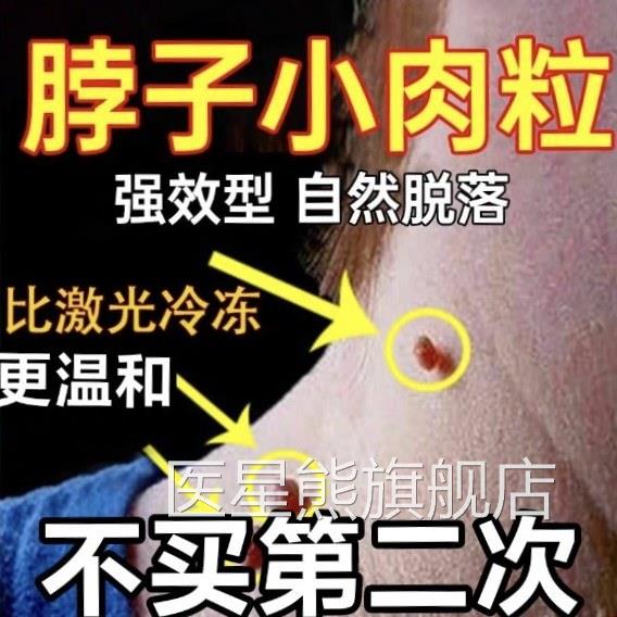 花强效去疣凝胶医用型疣体脱落药膏祛疣瘊丝状葵疣扁平疣去小肉粒