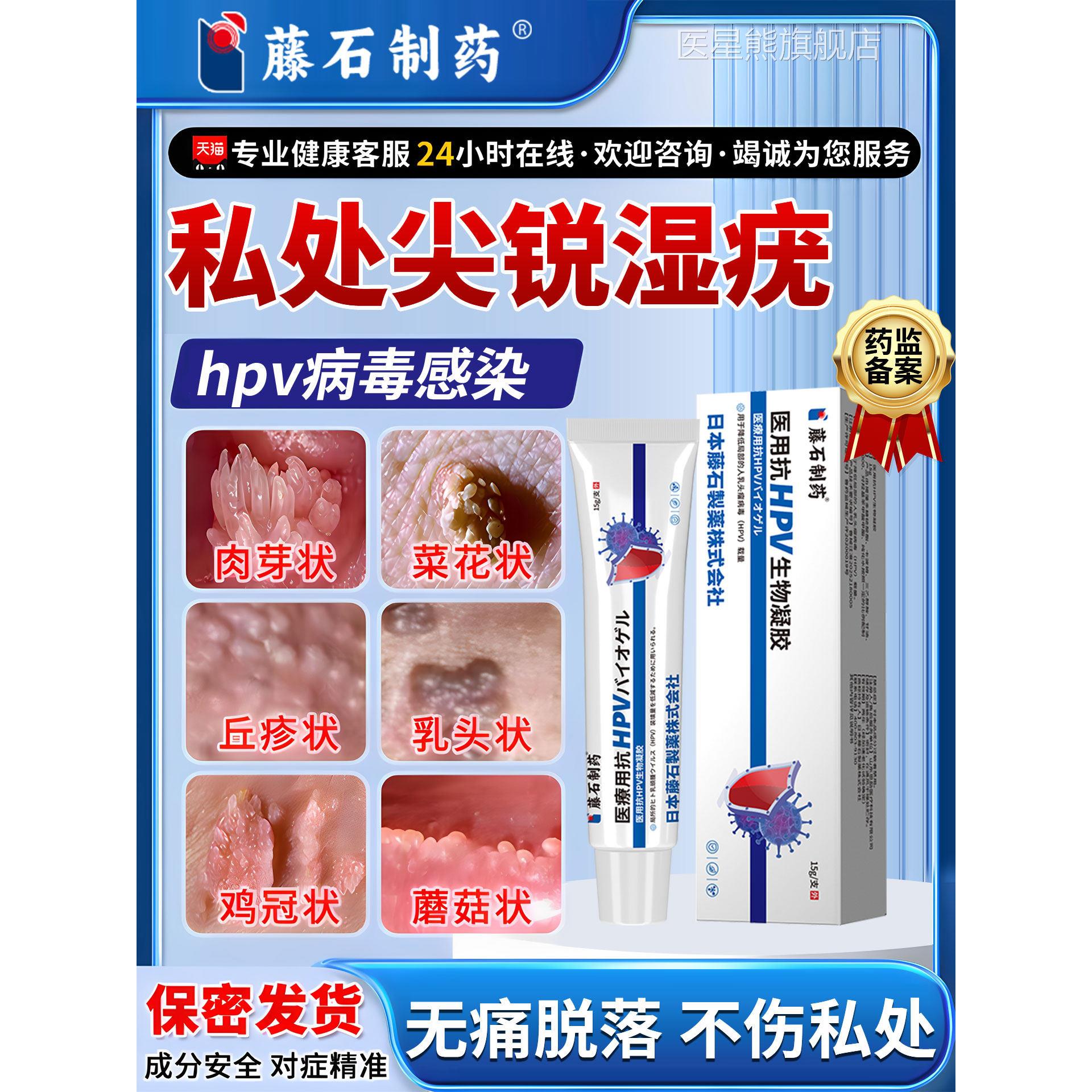 去外阴长肉粒菜花状肉芽尖锐湿疣专膏用阴道小肉疙瘩私口处去除CA