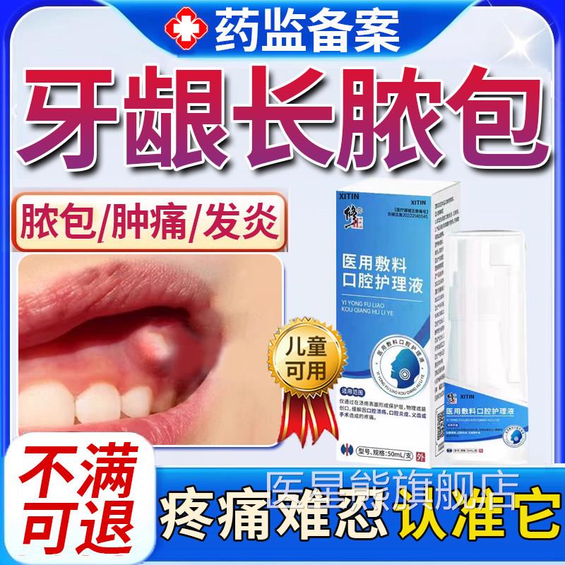 牙龈脓包肿消炎专用喷剂牙根发炎上火肿痛包牙周炎增生息肉出血UU