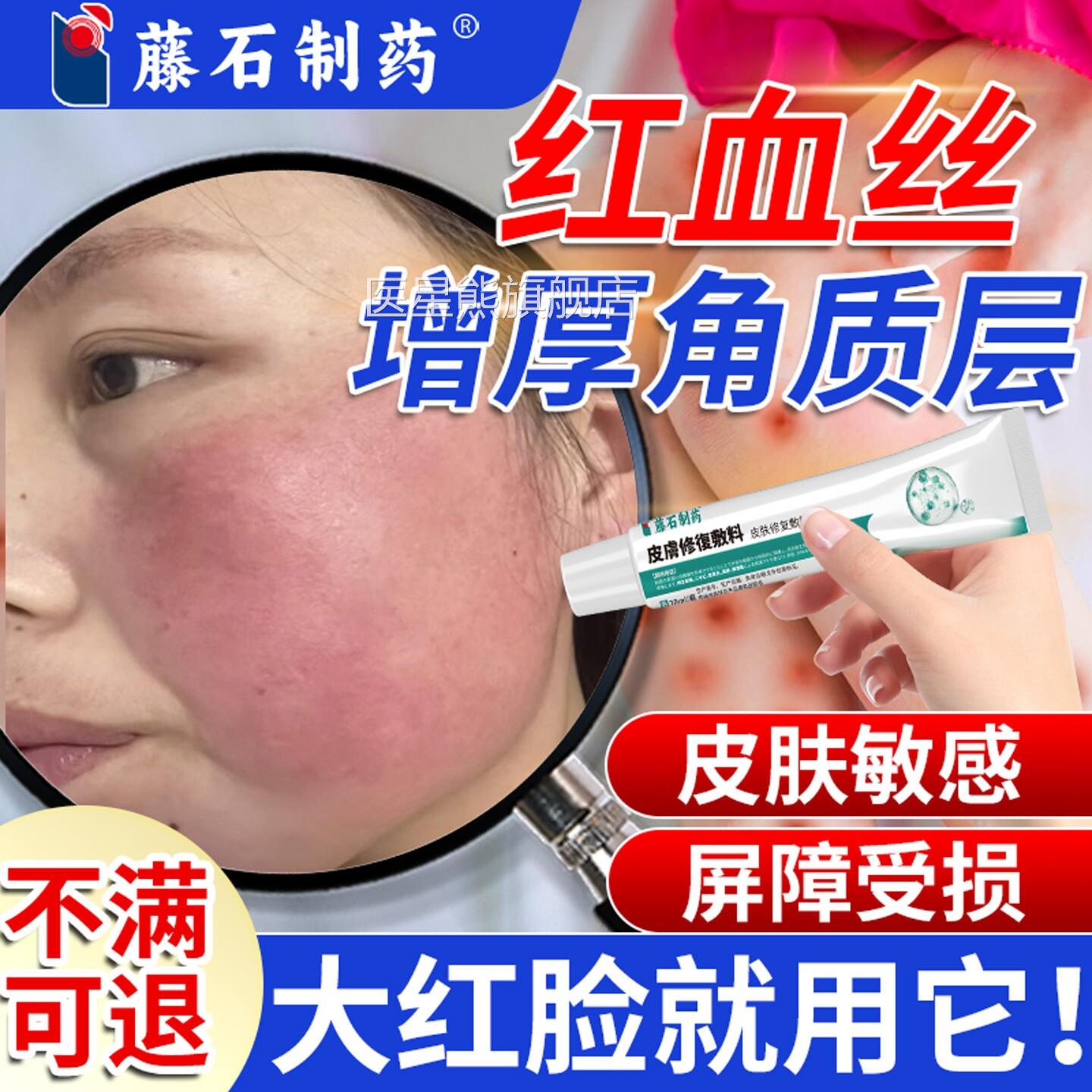 去脸脸上红血丝修复药膏角质层薄大红增厚角质层改善敏感肌医用YI