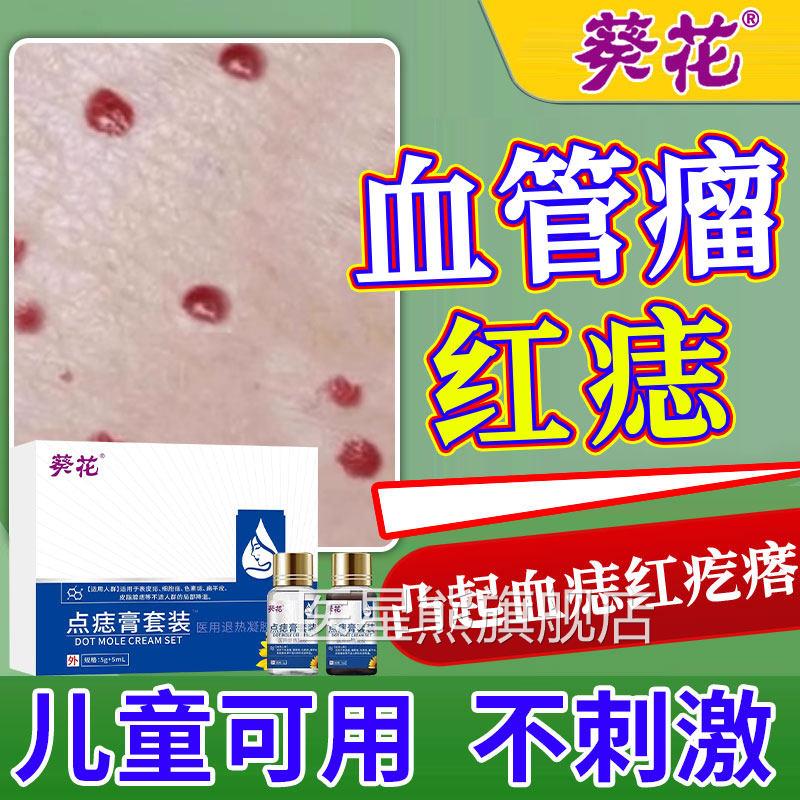 血管瘤膏凝胶樱药桃状点脖子胸口红痣血痣蜘蛛痣去除身上红点痣UU