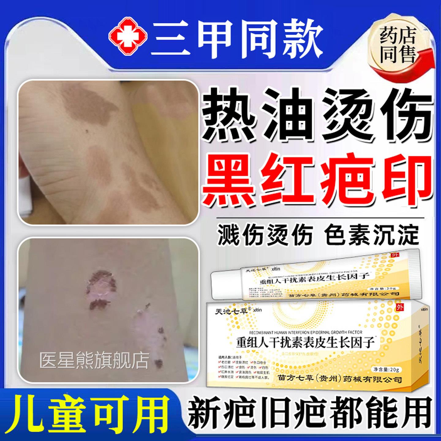 热油烫伤烧油伤去疤膏疤痕修覆除疤膏儿童祛去红印黑印色素沉淀TT
