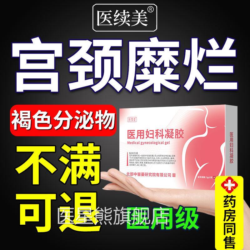 阴道褐色分泌物多白带多宫有红血丝量多出血异味颈糜烂妇科凝胶SK