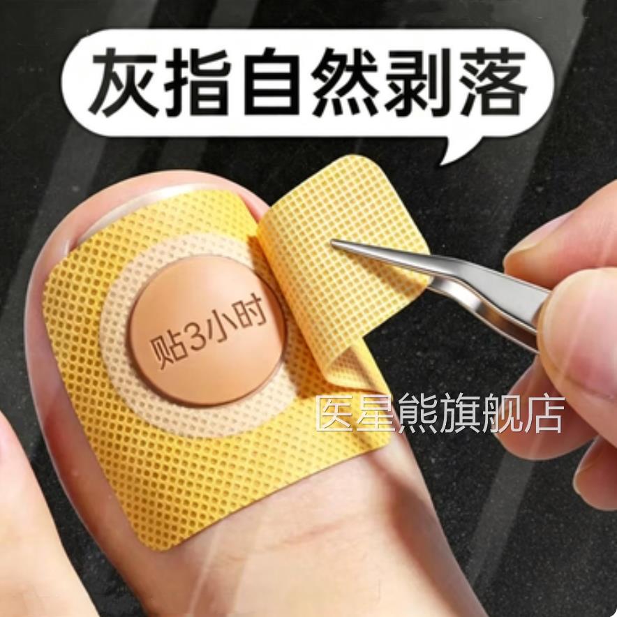 【断货王】灰趾厚增正品专用灰指贴发黄粉碎甲脚趾手指甲专用医星
