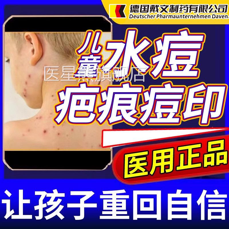 水痘坑疤痕去痘印痘黑坑痘疤药房同售膏去色素沉淀去疤医用型CA医