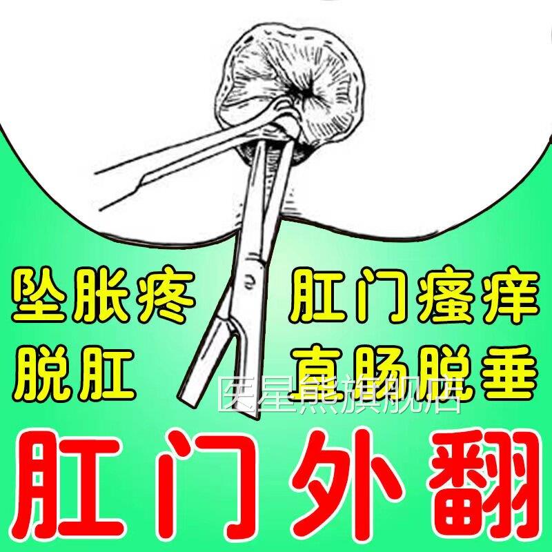 肛门长外翻肛门口红肿疙瘩肉球肛门疼痛直肠脱垂便后脱出肛周脓肿