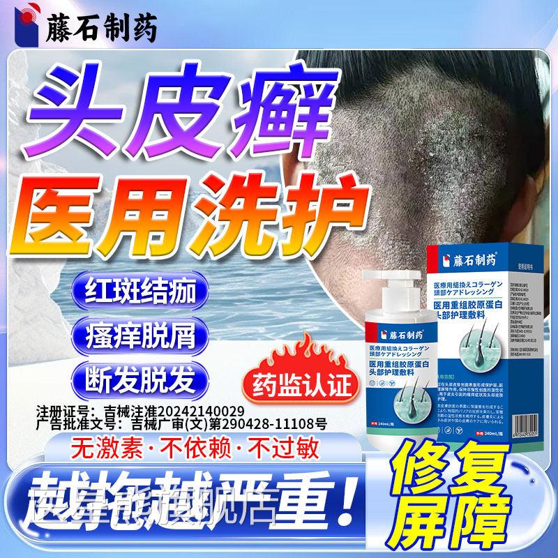 头皮癣医专用洗发治N去真菌感染溢脂性毛囊炎红疙瘩瘙痒脱屑6医星