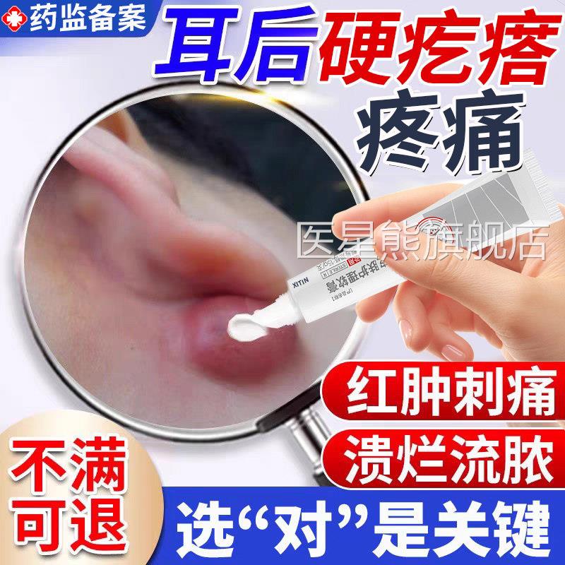 耳后鼓包长硬块痘疙瘩皮脂腺囊肿粉瘤疖肿拔毒拔脓专用疖火子UU医