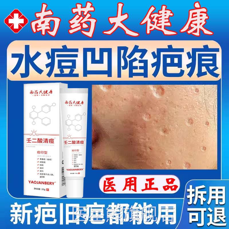 水痘痘疤痕修复去水坑痘坑凹洞修复生长因子凹陷性疤痕修复填充gx